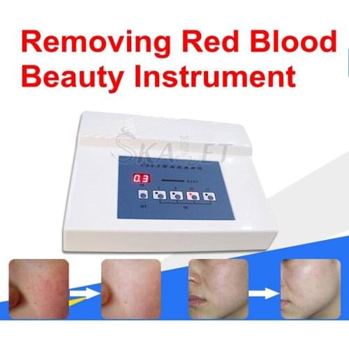 High Frequency Needle RF Spider Veins Removal Anti Redness Machine Anti Redness Machine with CE