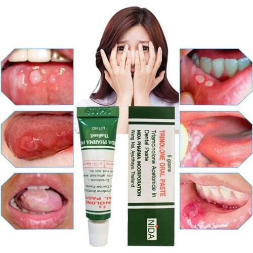 10pcs Mouth Ulcer Relief Gel Natural Herbal Oral Antibacterial Cream Fast Relief from Severe Pain & Irritation Oral Care