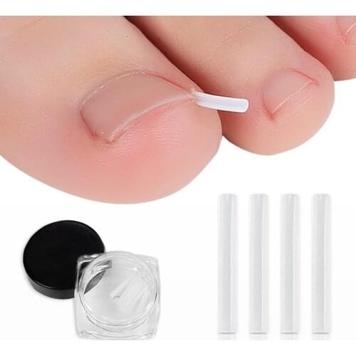10 Piece Ingrown Pads Nail Groove Orthopedic Pads Nail Correction Devices Correction Treatments Sticker Patch Foot Care Tools