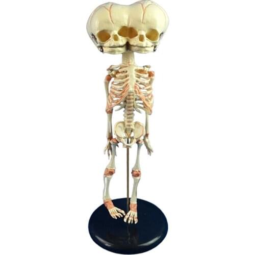 Human New Born Double Head Baby Anatomy Skull Skeleton Anatomical Brain Anatomy Education Model Anatomical Study Display Model