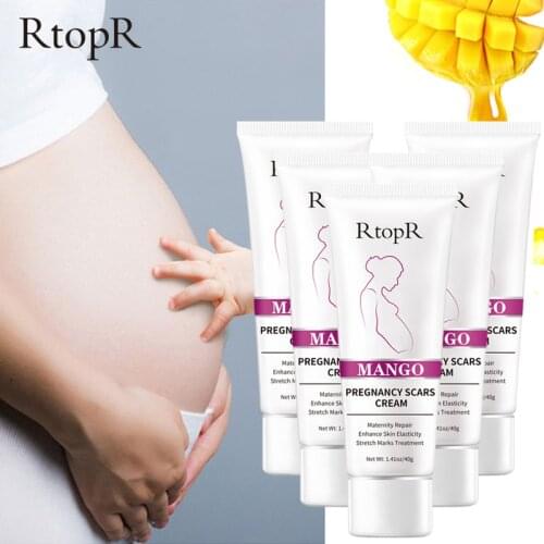 5pcs RtopR Mango Improves Skin Reduces Wrinkles Remove Skin Scars Treatments Pregnant Women Skin Cream Increases Skin Elasticity