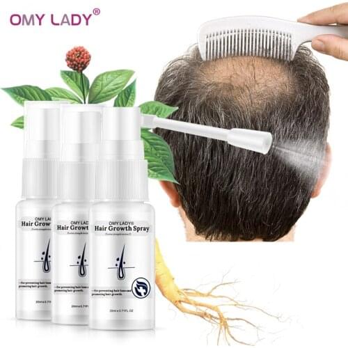OMY LADY Anti Hair Loss Hair Growth Spray Essential Oil Liquid For Men Women Dry Hair Regeneration Repair Hair Loss Products