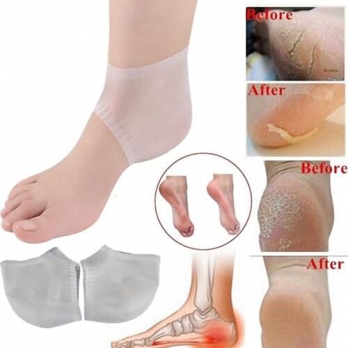 2Pcs Silicone Moisturizing Feet Care Socks Gel Heel Thin Socks Cracked Foot Skin Care Protectors Foot Care Tool 2Colors