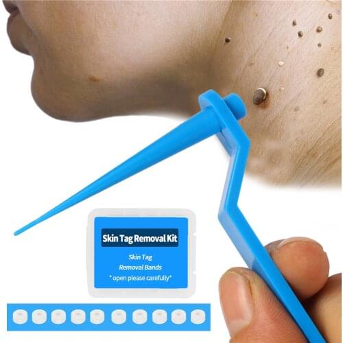 1set Skin Tag Kill Skin Mole Wart Remover Micro Skin Tag Removal Kit with Cleansing Swabs Adult Mole Wart Face Care