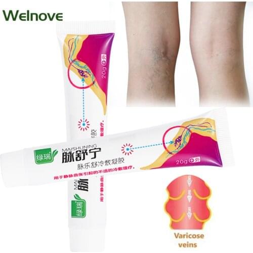 1pcs 20g Varicose Veins Treatment Cream Varicosity Angiitis Remedy Medical Ointment Relief Veins Pain Phlebitis Legs Pain Relief