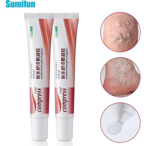 Sumifun Pain Relief Varicose Veins Cream Herbal Analgesic Plaster Varicosity Angiitis Remedy Phlebitis Spider Leg Ointment
