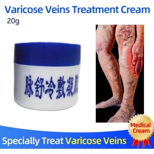 Herbal Medicine for Treating Varicose Vasculitis Phlebitis Spider Legs Veins Pain Massage Cream Relief Varices Vein Ointment