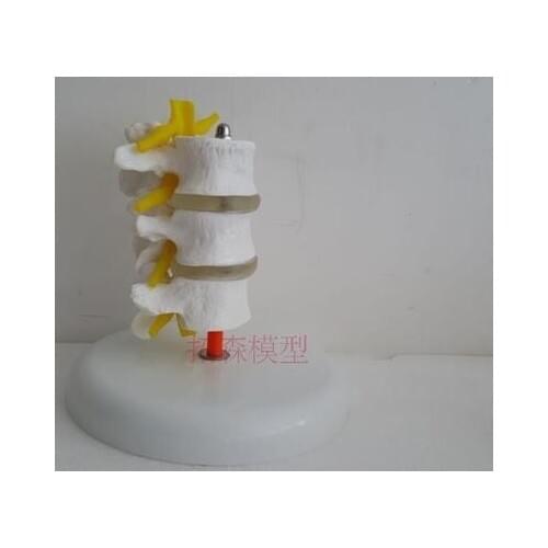Lumbar Model Teaching joint skeleton model free shipping