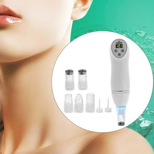 Black Head Remover with Hot Compress Vibration Function Face Pore Cleaner Plug-US