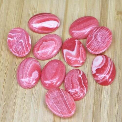 Fashion High Quality Stripe Onyx Oval CAB CABOCHON Beads for Jewelry Accessories Making 18x25mm Wholesale 30pcs/lot Free