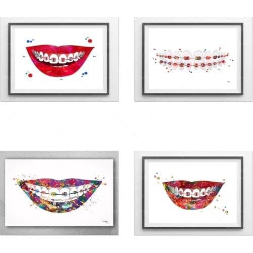 Dental Art Print Braces Aquarelle Dents Anatomie Art Poster Stomatology Dentist Clinic Wall Art Teeth Braces Print Dental Care O