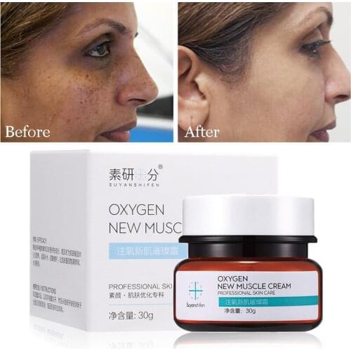 30g Effective Whitening Face Cream Remove Freckles Fade Dark Spots Moisturizing Gel Brightening Facial Beauty Skin Care Cream