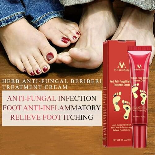 1PC Herbal Foot Cream Treatment Anti Fungal Infection Care Crack Gel Paronychia Onychomycosis Repair Feet Dry Toe Fungus V5V9