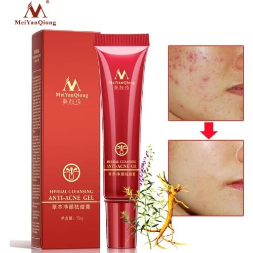 Skin Care Acne Cleaning Cream Remove Repair Pimple Acne Quickly Face Acne Cream Remover Anti Acne Treatment