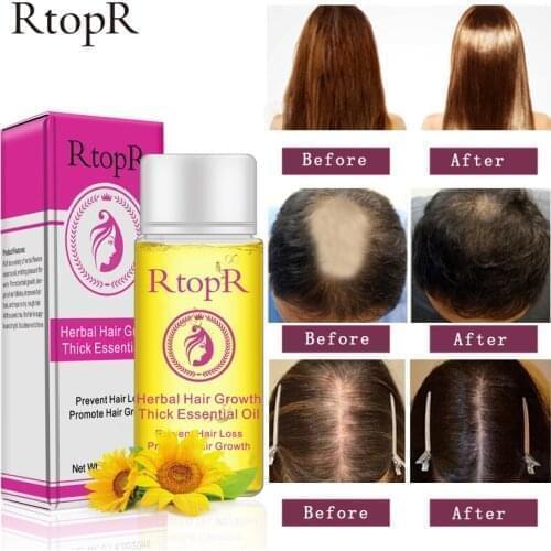 20ml Herbal Fast Hair Growth Serum Essential Oil Anti Preventing Hair Lose Liquid Damaged Hair Repair Growing Dropship