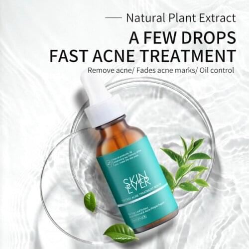 SKIN EVER 30ml Tea Tree Acne Face Serum Moisturizing Repair Skin Oil Control Acne Removal Pimple Essence Skin Face Care TSLM2