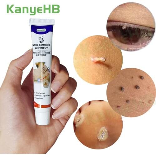 Wart Removal Body Warts Treatment Cream Foot Care Cream Skin Tag Remover Foot Corn Calluses Removal Plantar Warts Ointment 1pcs