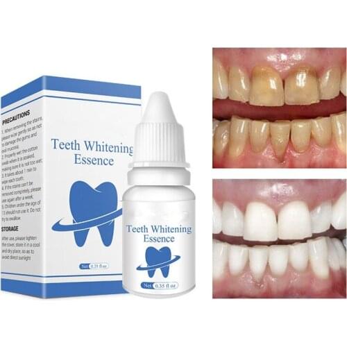 Teeth Whitening Essence 10ml Tooth Brighten Liquid With Cotton Swabs Dental Cleansing Serum to Remove Tooth Stains