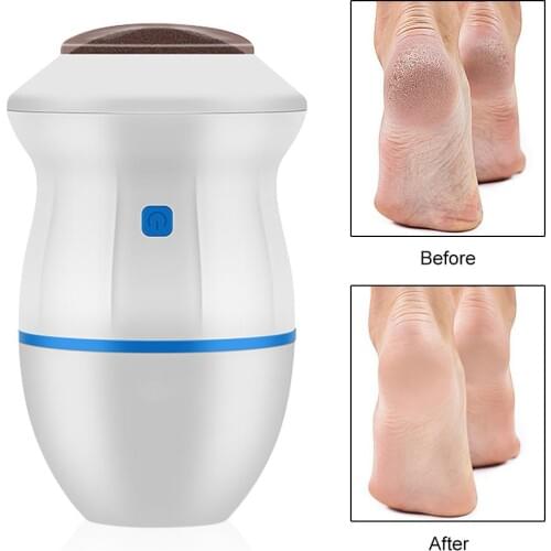 Electric Vacuum Adsorption Foot Grinder Foot File Vacuum Callus Remover Foot Files Clean Tools Feet Care For Hard Cracked Skin