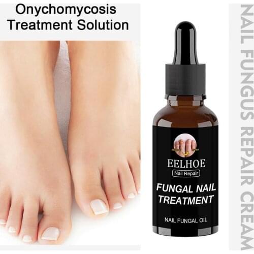 New Nail Repair Solution Toe Nail Treatment For Toe & Fungus Infections Nail Anti-Fungal Care Nail I0N3