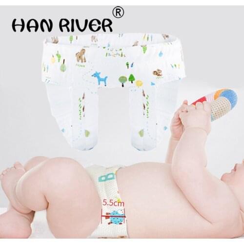 Pediatric inguinal hernia male baby child infant small intestine gas prominent navel newborn umbilical cord hernia belt J2296