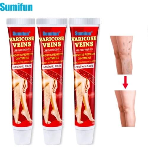 Sumifun 1/3pcs Varicose Veins Ointment Vasculitis Phlebitis Spider Veins Pain Treatment Cream Varicosity Angiitis Ointment P1149