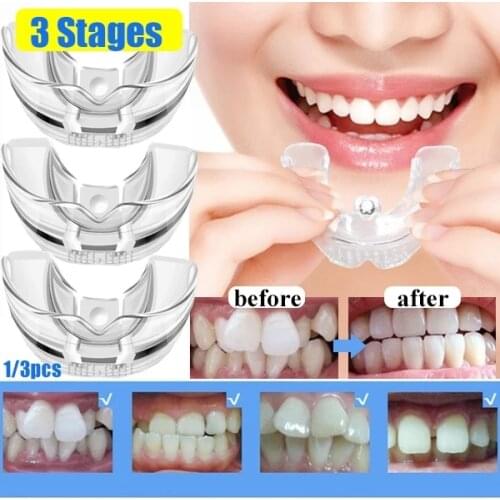 3 Stages Dental Braces for Teeth Straightener Orthodontic Appliance Fake Braces Trainer for Teeth Alignment 3 Phases for Adults