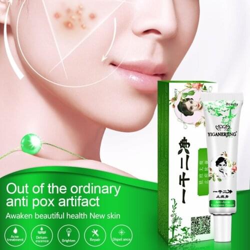 30g/tube YIGANERJING Soothing Moisturizing Whitening Cream Anti-Acne cream Face Care acne treatment skin care products