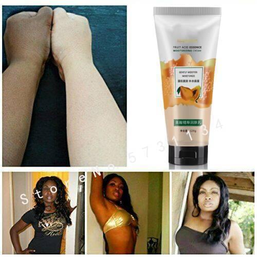 Super White AHA Body Lotion Serum Remove Dark Spots Skin Lightening Bleaching Body Skin