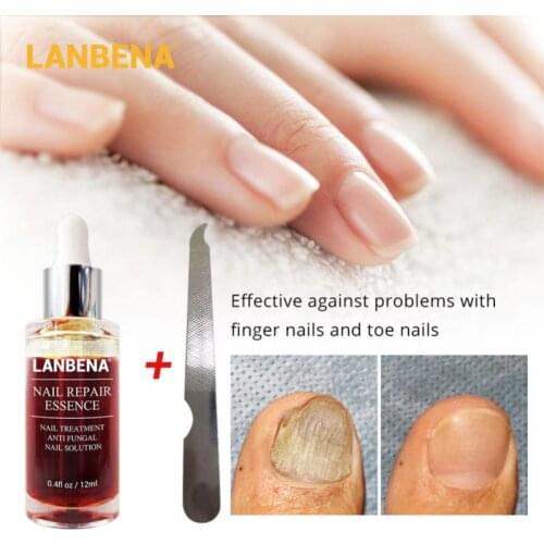 LANBENA 12ml Nail Repair Serum Remove Onychomycosis Serum Nail Art Nail Brighten Hand Foot Nail Care TSLM1
