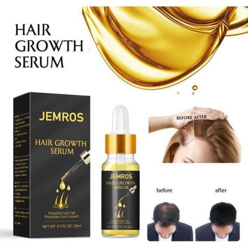 20ml Ginger Hair Growth Treatment Serum Air Lose Growing Damaged Liquid Hair Oil Repair Essential B4K7