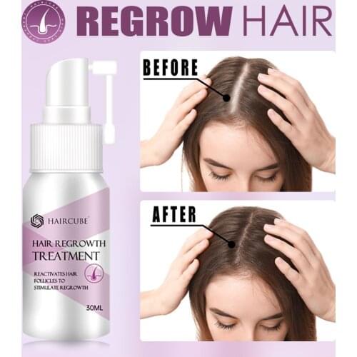 HAIRCUBE Hair Growth Essence Spray Hair Loss Treatment Stop Hair Loss Liquid Spray Hair Growth Essence Hair Care for Women 30ML