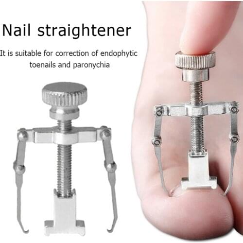 Ingrown Toenail Fixer Toe Recover Correction Device Toe Corrector Toenail Straightening Clip Pedicure Foot Nail Care