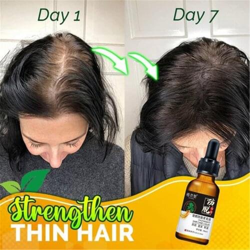 30ml Ginger Hair Hair Growth Serum Essence Oil Regro Growth Hair Loss Liquid Health Care Beauty Hair Treatment for Men Women