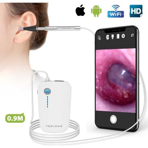 Teslong WiFi Otoscope for iPhone & Android, Ear Camera and Wax Removal Tool, 3.9mm HD Ear Cleaning Camera with Ear Pick