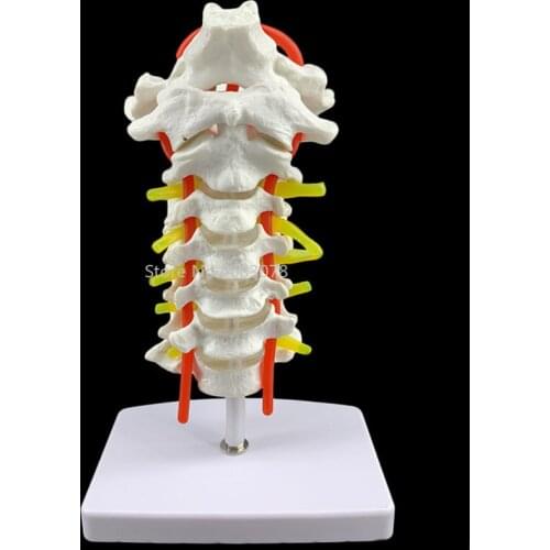 Human Anatomical Model Cervical Vertebra Model Cervical Spine with Neck Artery Occipital Bone Disc and Nerve Model 18 x 13 x 8cm