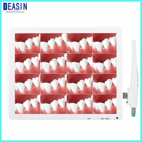 Dental endoscope 5.0 mega pixels 17inch LCD monitor with USB intra oral camera all in one machine