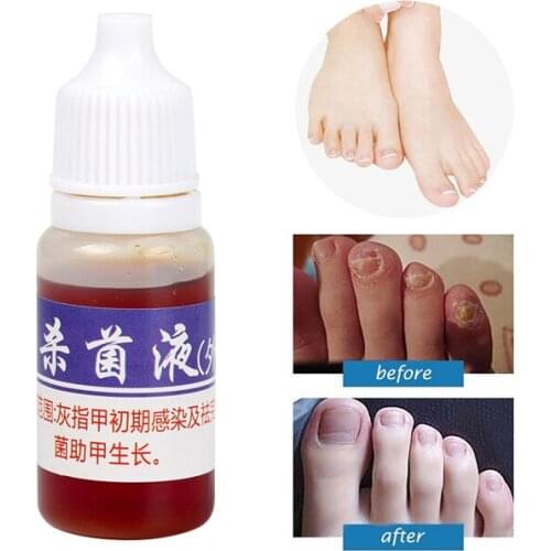 High Quality Nail Treatment Liquid Nourish Antifungal Nails Infection Chinese Herbs Liquid