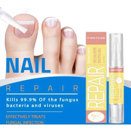 Powerful Nail Treatment Pen Onychomycosis Paronychia Anti Fungal Nail Infection Chinese Herbal Toe Fungus Care Repair Serum