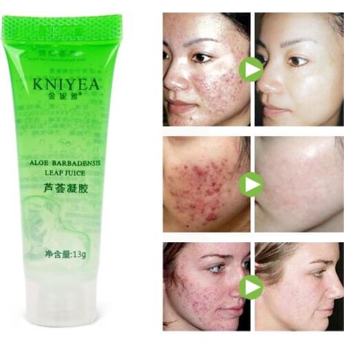 1pcs Natural Aloe Vera Gel Face Moisturizing Smoothing Cream Acne Remover Sunscreen Acne Treatment Facial Skin Care Base Primer