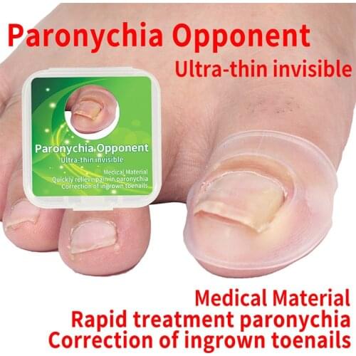 2pcs Silicone Ingrown Toe Nail Corrector Clear Paronychia Recover Correction Portable Pedicure Device Foot Toe Nail Care Tools