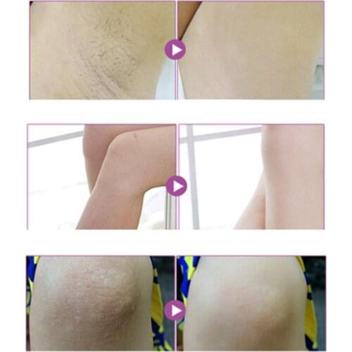 Hot Sale Beauty Body Creams Armpit Whitening Cream Between Legs Knees Private Parts Whitening Formula Intimate Armpit Whitener