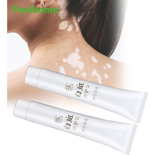 Vitiligo Leukoplakia Disease Treatment Ointment White Spot Disease Repair Cream Chinese Medical Pigment Melanin Skin Care Balm