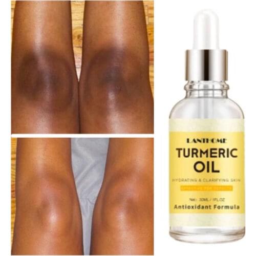 New turmeric oil moisturizing, anti-wrinkle and anti-acne facial oil