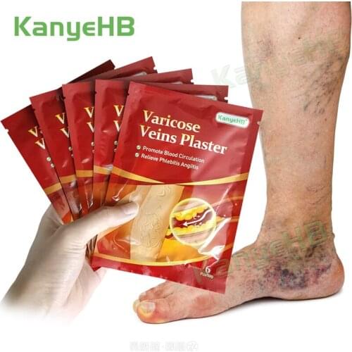 24pcs/4bags Varicose Veins Plaster Traditional Medicine Vasculitis Phlebitis Cream Leg Medical Patch Angiitis Removal Patch A595