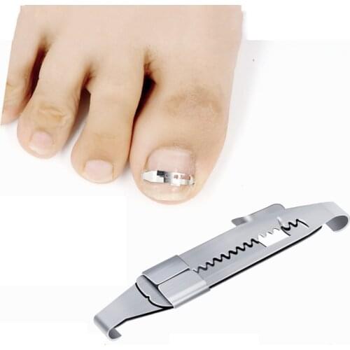 Ingrown Toenail Pedicure Tools Professional Recover Embed Toe Nail Treatment Paronychia Bunion Hallux Valgus Corrector Foot Care