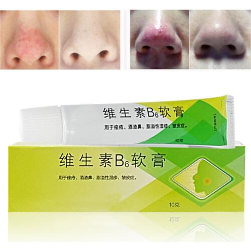 Rosacea Cream Red Nose Ointment Remove Blackhead Acne Cream Skin Care Herbal Anti Acne and Mite Acne Rosacea Treat Shrink Pores
