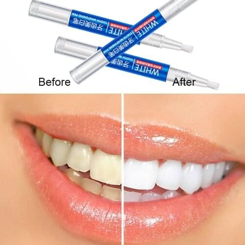 Teeth Whitening Pen Cleaning Serum Remove Plaque Stains Dentals Tool Whiten Teeth Oral Hygiene Tooth Whitening Pen Mint Whitener