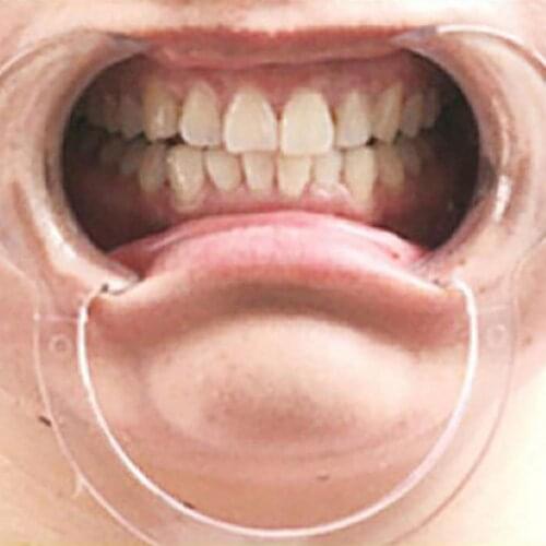 2Pcs Transparent Mouth Expansion Teeth Braces Tricky Toys Cosplay Party Props Kids Educational Toys for Children Gifts