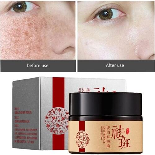 Whitening Freckle Cream Chinese Herbal Plant Face Cream Remove Freckles and Dark Spots Skin whitening cream